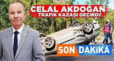 Celal Akdoğan trafik kazası geçirdi!