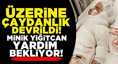 Üzerine çaydanlık devrildi! Minik Yiğitcan yardım bekliyor!