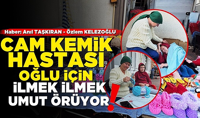 Cam kemik hastası oğlu için ilmek ilmek umut örüyor!